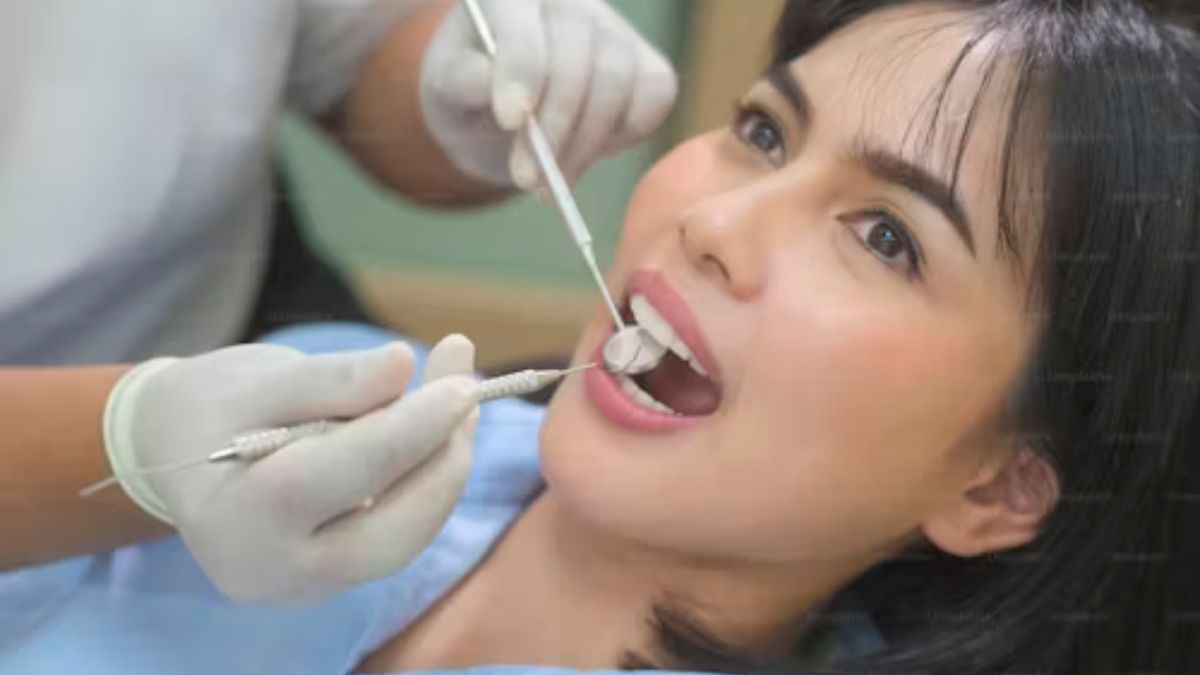 Dental Cleaning