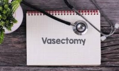 Vasectomy